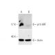 p14ARF Antibody (DCS-241) - Western Blotting - Image 315561 