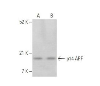 p14ARF Antibody (DCS-241) - Western Blotting - Image 349906 