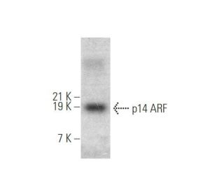 western blotting image from recommended p14ARF (ARF 4C6/4) monoclonal antibody replacement. Image 349907