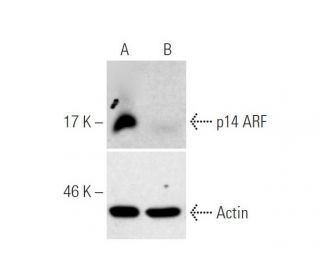 p14 ARF/p16 CRISPR/Cas9 KO Plasmid transfected: sc-400018. Western blot analysis... 