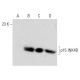 CDKN2B/p15 INK4B Antibody (D-12) - Western Blotting - Image 136996