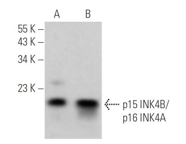 たろきち TIP60 Antibody (C-7) | SCBT - Santa Cruz Biotechnology