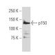 p150 Antibody (JK-13) - Western Blotting - Image 34172 