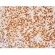 CDKN2A/p16 Antibody (1E12E10) - Immunohistochemistry - Image 411715 