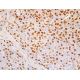 CDKN2A/p16 Antibody (1E12E10) - Immunohistochemistry - Image 411716
