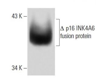 CDKN2A/p16 Antibody (1E12E10) - Western Blotting - Image 137432 