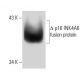 CDKN2A/p16 Antibody (1E12E10) - Western Blotting - Image 137432 