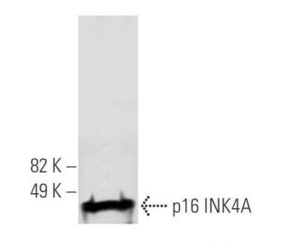 CDKN2A/p16 Antibody (2D9A12) - Western Blotting - Image 19569 