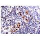 CDKN2A/p16 Antibody (DCS-50) - Immunohistochemistry - Image 157188