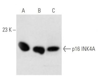 CDKN2A/p16 Antibody (DCS-50) - Western Blotting - Image 15233 