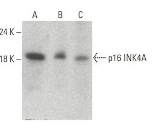 CDKN2A/p16 Antibody (F-12) - Western Blotting - Image 396012 