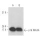 CDKN2A/p16 Antibody (F-4) - Western Blotting - Image 15488