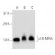 CDKN2A/p16 Antibody (F-4) - Western Blotting - Image 147350 