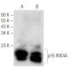CDKN2A/p16 Antibody (F-8) - Western Blotting - Image 146419