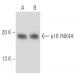 CDKN2A/p16 Antibody (F-9) - Western Blotting - Image 15455