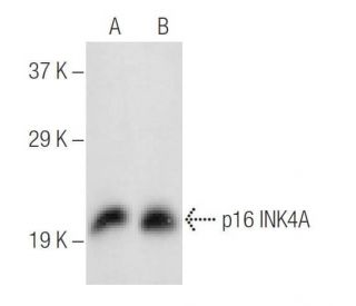 CDKN2A/p16 Antibody (F-9) - Western Blotting - Image 147349 