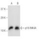 CDKN2A/p16 Antibody (F-9) - Western Blotting - Image 147349 