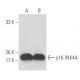 CDKN2A/p16 Antibody (G-6) - Western Blotting - Image 15487 