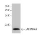 CDKN2A/p16 Antibody (G-6) - Western Blotting - Image 53588