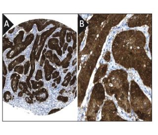 CDKN2A/p16 Antibody (JC8) | SCBT - Santa Cruz Biotechnology