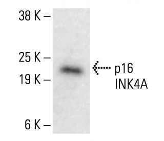 コメント者5/7 P16 p16-antibody-jc8-western-