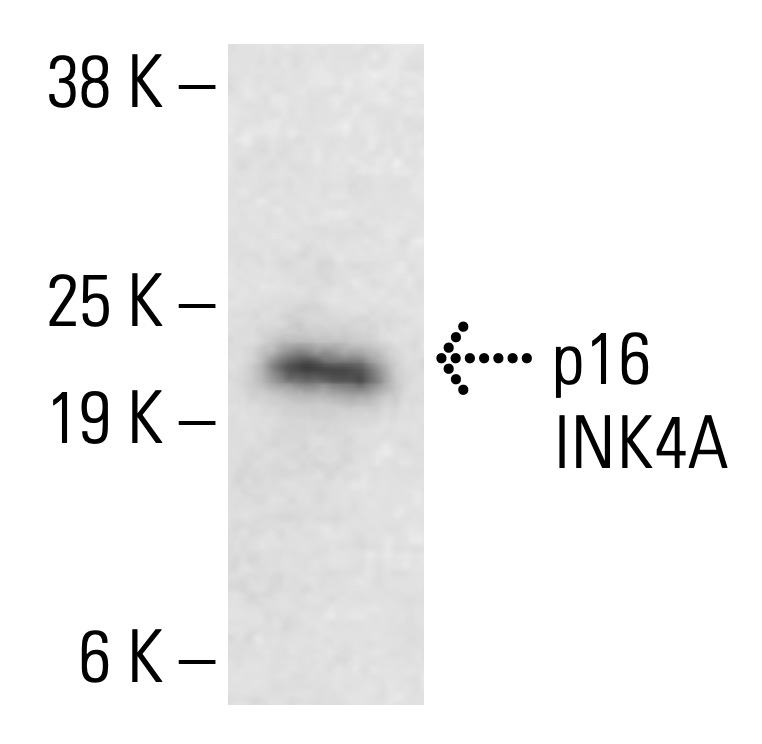 CDKN2A/p16 Antibody (JC8) | SCBT - Santa Cruz Biotechnology