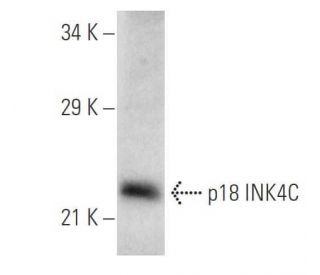 western blotting image from recommended CDKN2C/p18 INK4c (118.2) monoclonal antibody replacement. Image 701