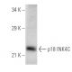 western blotting image from recommended CDKN2C/p18 INK4c (118.2) monoclonal antibody replacement. Image 701