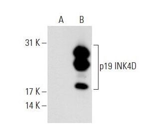 p19 INK4D/CDKN2D Antibody (0.N.485) - Western Blotting - Image 62705 