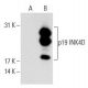 p19 INK4D/CDKN2D Antibody (0.N.485) - Western Blotting - Image 62705 