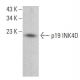 p19 INK4D/CDKN2D Antibody (0.N.485) - Western Blotting - Image 382149