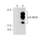 p19 INK4D/CDKN2D Antibody (2B2.59) - Western Blotting - Image 62693