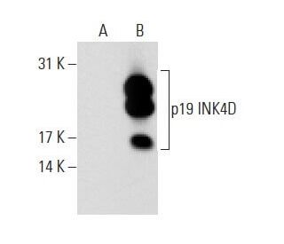 p19 INK4D/CDKN2D Antibody (6A150) - Western Blotting - Image 62703