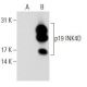 p19 INK4D/CDKN2D Antibody (6A150) - Western Blotting - Image 62703