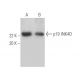 p19 INK4D/CDKN2D Antibody (D-9) - Western Blotting - Image 393548 