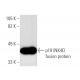 p19 INK4D/CDKN2D Antibody (E-11) - Western Blotting - Image 1714