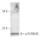 western blotting image from recommended p19 INK4D/CDKN2D (DCS-100) monoclonal antibody replacement. Image 14750