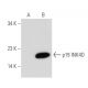 western blotting image from recommended p19 INK4D/CDKN2D (E-11) monoclonal antibody replacement. Image 43957