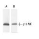 CDKN2A/p19ARF Antibody (12-A1-1) - Western Blotting - Image 9219 