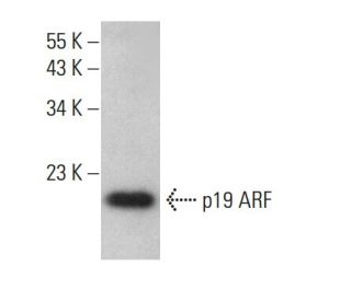 CDKN2A/p19ARF Antibody (12-A1-1) - Western Blotting - Image 377639 