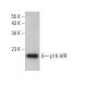 CDKN2A/p19ARF Antibody (12-A1-1) - Western Blotting - Image 377639 