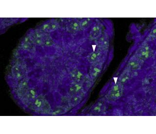 CDKN2A/p19ARF Antibody (5-C3-1) | SCBT - Santa Cruz