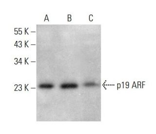 western blotting image from recommended CDKN2A/p19ARF (5-C3-1) monoclonal antibody replacement. Image 378741