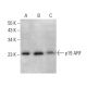 western blotting image from recommended CDKN2A/p19ARF (5-C3-1) monoclonal antibody replacement. Image 378741