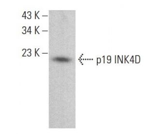 p19 INK4D/CDKN2D Antibody (0.N.485) - Western Blotting - Image 382149