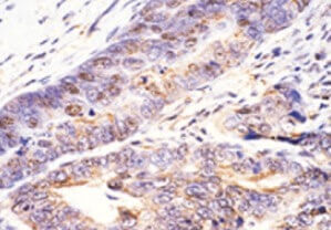 標本 Taiwan Dytiscoidae sp.37mm アルゼンチン産 Dichotomius bos