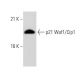 Waf1/Cip1/CDKN1A p21 Antibody (WA-1) - Western Blotting - Image 43967 