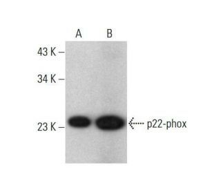 p22-phox Antibody (44.1) - Western Blotting - Image 351981 