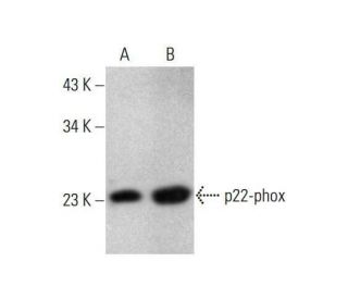 p22-phox Antibody (CS9) - Western Blotting - Image 351983 