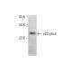 p22-phox Antibody (E-11) - Western Blotting - Image 351973